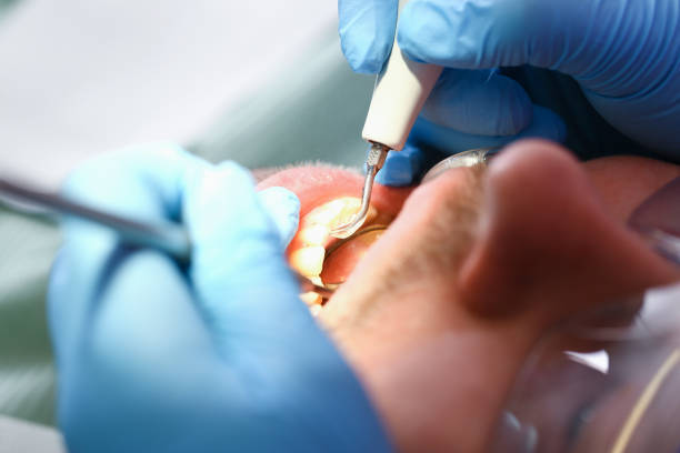 Best Emergency Gum Treatment in El Cerro Mission, NM